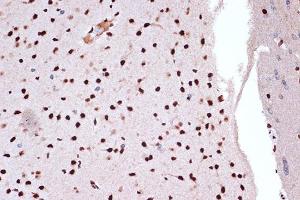 Immunohistochemistry of paraffin-embedded rat brain using FUBP1 Rabbit mAb (ABIN7267128) at dilution of 1:100 (40x lens). (FUBP1 抗体)