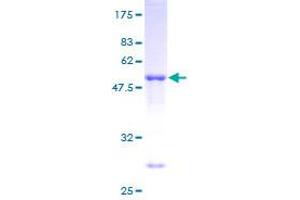 TIA1 Protein (AA 1-214) (GST tag)