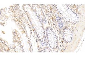 Detection of RNASE2 in Human Colon Tissue using Monoclonal Antibody to Ribonuclease A2 (RNASE2) (RNASE2 抗体  (AA 28-161))