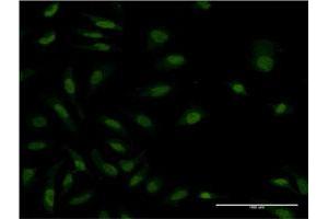 Immunofluorescence (IF) image for anti-Mitogen-Activated Protein Kinase Kinase Kinase MLT (ZAK) (AA 1-120) antibody (ABIN565679)
