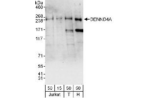 Western Blotting (WB) image for anti-DENN/MADD Domain Containing 4A (DENND4A) (AA 1525-1575) antibody (ABIN7452931)