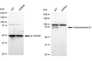 anti-Galactosidase, beta 1 (GLB1) antibody
