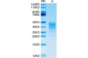 Human CD30 Ligand/TNFSF8 on Tris-Bis PAGE under reduced condition. (TNFSF8 Protein (AA 63-234) (His tag))