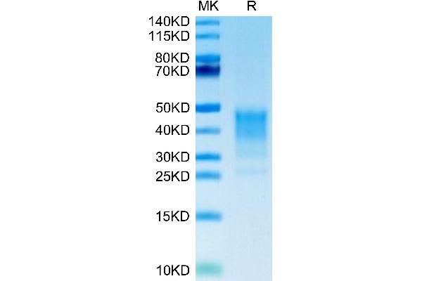TNFSF8 Protein (AA 63-234) (His tag)