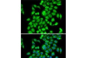 Immunofluorescence analysis of MCF7 cells using COPS3 Polyclonal Antibody (COPS3 抗体)