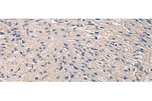 Immunohistochemistry of paraffin-embedded Human brain tissue using PRKCSH Polyclonal Antibody at dilution of 1:90(x200) (PRKCSH 抗体)