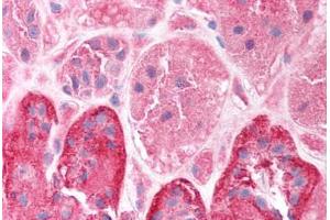 Human Kidney (formalin-fixed, paraffin-embedded) stained with CLIC5 antibody ABIN214746 at 2. (CLIC5 抗体  (C-Term))