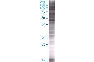 APOBEC3B transfected lysate. (APOBEC3B 293T Cell Transient Overexpression Lysate(Denatured))