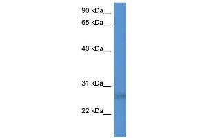 Western Blotting (WB) image for anti-SplA/ryanodine Receptor Domain and SOCS Box Containing 2 (SPSB2) (N-Term) antibody (ABIN2788510)