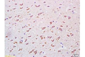 Formalin-fixed and paraffin embedded rat brain tissue labeled Anti-PEGF Polyclonal Antibody, Unconjugated  at 1:200, followed by conjugation to the secondary antibody and DAB staining (PEDF 抗体  (AA 201-300))