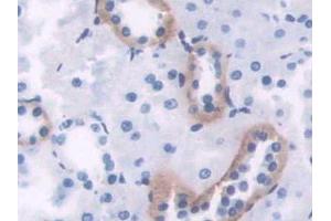 DAB staining on IHC-P; Samples: Rat Kidney Tissue (PIM1 抗体  (AA 38-177))