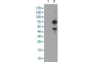 Western Blot analysis of HEK293T cells (Lane 1: transfected with pCMV6-ENTRY control and Lane 2: transfected with pCMV6-ENTRY TRMT2A cDNA) with TRMT2A monoclonal antibody, clone 1G8 . (TRMT2A 抗体)