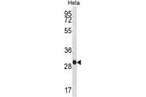 WFDC1 Antibody (C-term H163) western blot analysis in Hela cell line lysates (35 µg/lane). (WFDC1 抗体  (C-Term, His163))