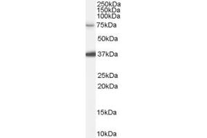 Western Blotting (WB) image for anti-Neural Precursor Cell Expressed, Developmentally Down-Regulated 1 (NEDD1) (Internal Region) antibody (ABIN2465989) (NEDD1 抗体  (Internal Region))