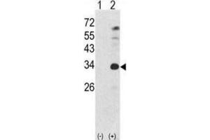 Western Blotting (WB) image for anti-Nanog Homeobox (NANOG) antibody (ABIN2998310) (Nanog 抗体)
