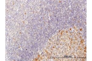 Immunoperoxidase of purified MaxPab antibody to C10orf7 on formalin-fixed paraffin-embedded human tonsil. (CDC123 抗体  (AA 1-336))