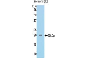 Detection of Recombinant TNC, Rat using Polyclonal Antibody to Tenascin C (TNC) (TNC 抗体  (AA 175-342))