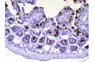 IHC analysis of TFF3 using anti-TFF3 antibody . (TFF3 抗体  (AA 23-81))
