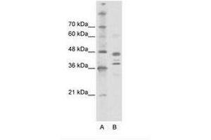 Image no. 1 for anti-SWI/SNF Related, Matrix Associated, Actin Dependent Regulator of Chromatin, Subfamily B, Member 1 (SMARCB1) (AA 212-261) antibody (ABIN6736126) (SMARCB1 抗体  (AA 212-261))