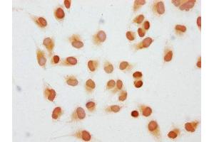 Immunocytochemistry analysis of ABIN7139280 diluted at 1:10 and staining in Hela cells performed on a Leica BondTM system. (HIST1H1C 抗体  (2meLys45))