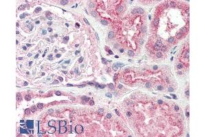 ABIN190757 (5µg/ml) staining of paraffin embedded Human Kidney. (OGG1 抗体  (Internal Region))