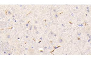 Immunohistochemistry (IHC) image for anti-Fibrinogen gamma Chain (FGG) (AA 168-405) antibody (ABIN7437560)