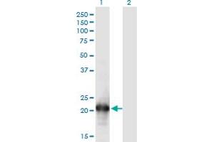 Western Blot analysis of HN1L expression in transfected 293T cell line by HN1L monoclonal antibody (M05), clone 1G8. (HN1L 抗体  (AA 1-190))
