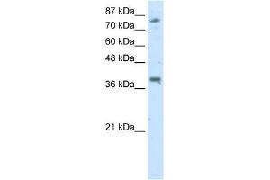 WB Suggested Anti-TSC22D2 Antibody Titration:  2. (TSC22D2 抗体  (C-Term))