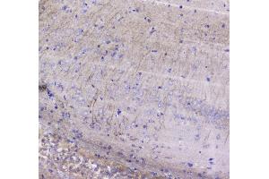 IHC analysis of Betacellulin using anti-Betacellulin antibody . (Betacellulin 抗体  (AA 32-177))