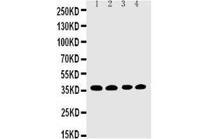 Anti-EIF2S1 antibody, Western blotting Lane 1: COLO320 Cell Lysate Lane 2: CEM Cell Lysate Lane 3: RAJI Cell Lysate Lane 4:  Cell Lysate