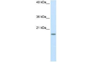 WB Suggested Anti-RPS14 Antibody Titration:  2. (RPS14 抗体  (Middle Region))