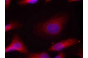 Immunofluorescence staining of methanol-fixed Hela cells using Src(Phospho-Tyr529) Antibody.