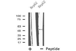 Western blot analysis of extracts from HepG2 cells, using IL13RA2 antibody. (IL13RA2 抗体  (C-Term))