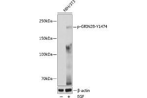 Western blot analysis of extracts of various cell lines, using Phospho-GRIN2B-Y1474 pAb (ABIN6135230, ABIN6136094, ABIN6136095 and ABIN6225667) at 1:1000 dilution. (GRIN2B 抗体  (pTyr1474))