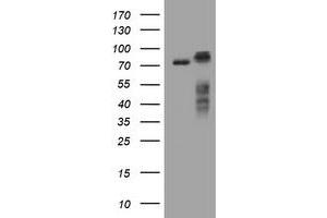 Image no. 1 for anti-Receptor (TNFRSF)-Interacting serine-threonine Kinase 1 (RIPK1) (AA 133-422) antibody (ABIN1490911)