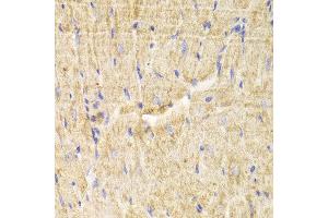 Immunohistochemistry of paraffin-embedded Mouse heart using PDLIM5 antibody at dilution of 1:100 (x400 lens). (PDLIM5 抗体)