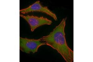 Immunofluorescent analysis of 4 % paraformaldehyde-fixed, 0. (PLEC 抗体  (AA 4241-4275))