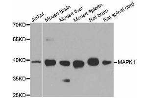 Western blot analysis of extracts of various cell lines, using MAPK1 antibody. (ERK2 抗体  (AA 200-300))