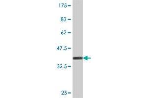 Western Blot detection against Immunogen (37. (CTNS 抗体  (AA 1-100))