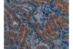 Figure. (MMP12 抗体  (AA 290-469))