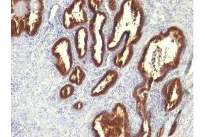 Image no. 1 for anti-Keratin 18 (KRT18) antibody (ABIN6179389) (Cytokeratin 18 抗体)