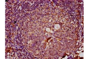 IHC image of ABIN7151049 diluted at 1:100 and staining in paraffin-embedded human tonsil tissue performed on a Leica BondTM system. (RNF160 抗体  (AA 462-591))