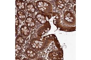 Immunohistochemical staining of human colon with LCMT2 polyclonal antibody  shows strong cytoplasmic positivity in glandular cells at 1:50-1:200 dilution. (LCMT2 抗体)