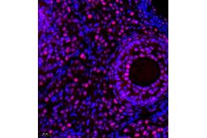Immunofluorescence (Paraffin-embedded Sections) (IF (p)) image for anti-General Transcription Factor IIIC, Polypeptide 2, beta 110kDa (GTF3C2) antibody (ABIN7074038)