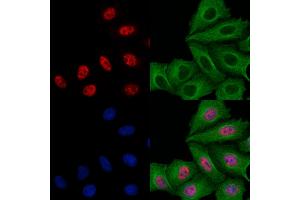 ABIN6258622 and ABIN6273497 staining Hela cells by IF/ICC.