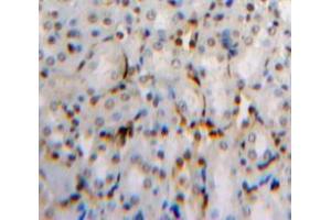 Used in DAB staining on fromalin fixed paraffin-embedded Kidney tissue (Dual Specificity Phosphatase 3 (DUSP3) (AA 2-185) 抗体)