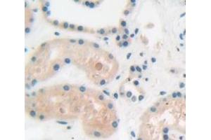 Immunohistochemistry (IHC) image for anti-Myosin, Light Chain 12A, Regulatory, Non-Sarcomeric (MYL12A) (AA 10-171) antibody (ABIN1859937)