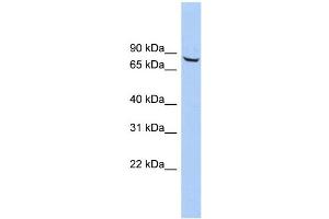 WB Suggested Anti-ACCN4 Antibody Titration: 0. (ACCN4 抗体  (Middle Region))
