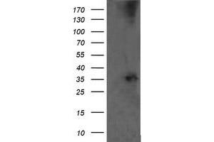 Western Blotting (WB) image for anti-T-cell surface glycoprotein CD1c (CD1C) antibody (ABIN2670667) (CD1c 抗体)