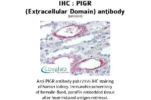 Image no. 1 for anti-Polymeric Immunoglobulin Receptor (PIGR) (Extracellular Domain) antibody (ABIN1738097) (PIGR 抗体  (Extracellular Domain))